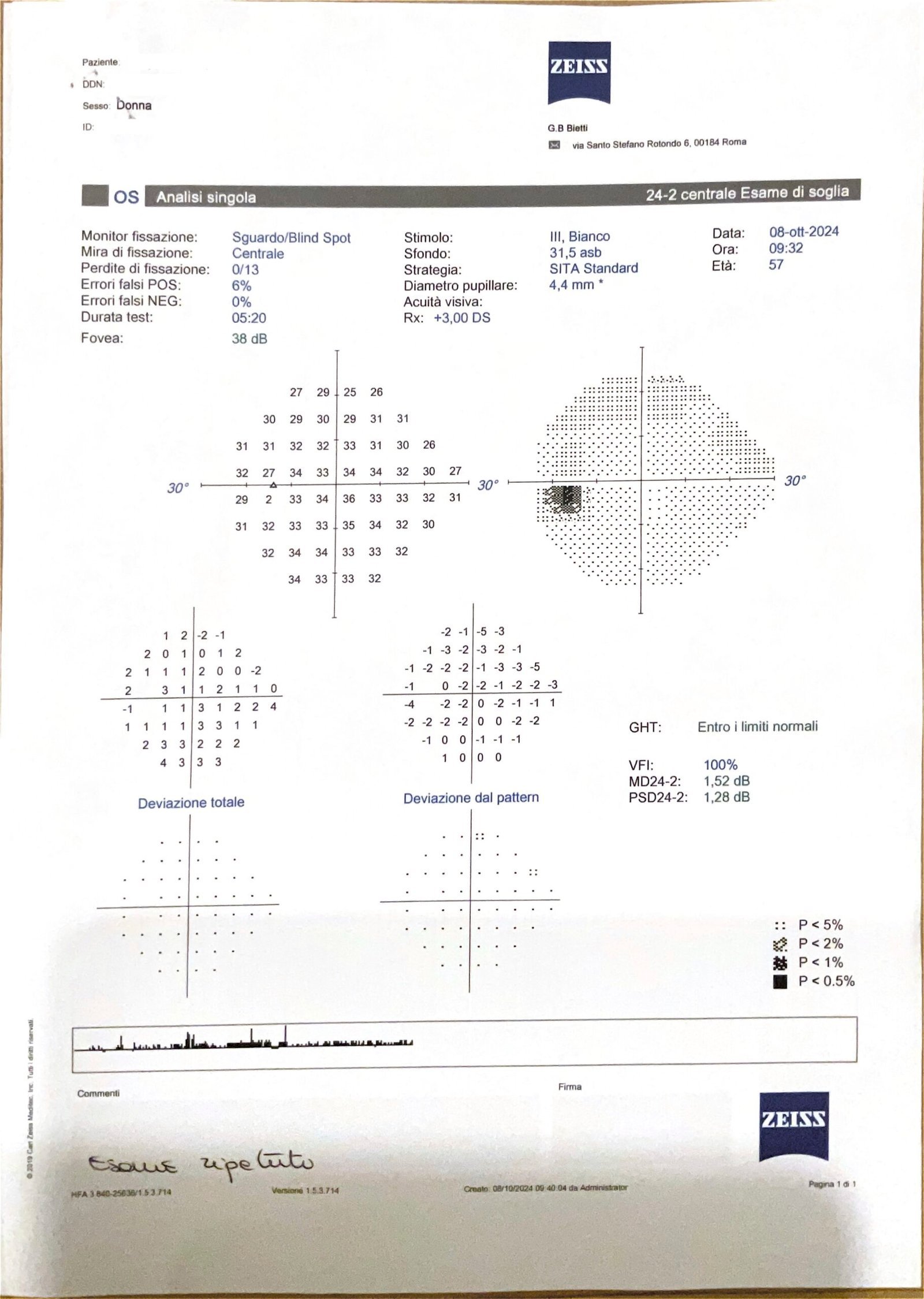 Glaucoma Campo Visivo