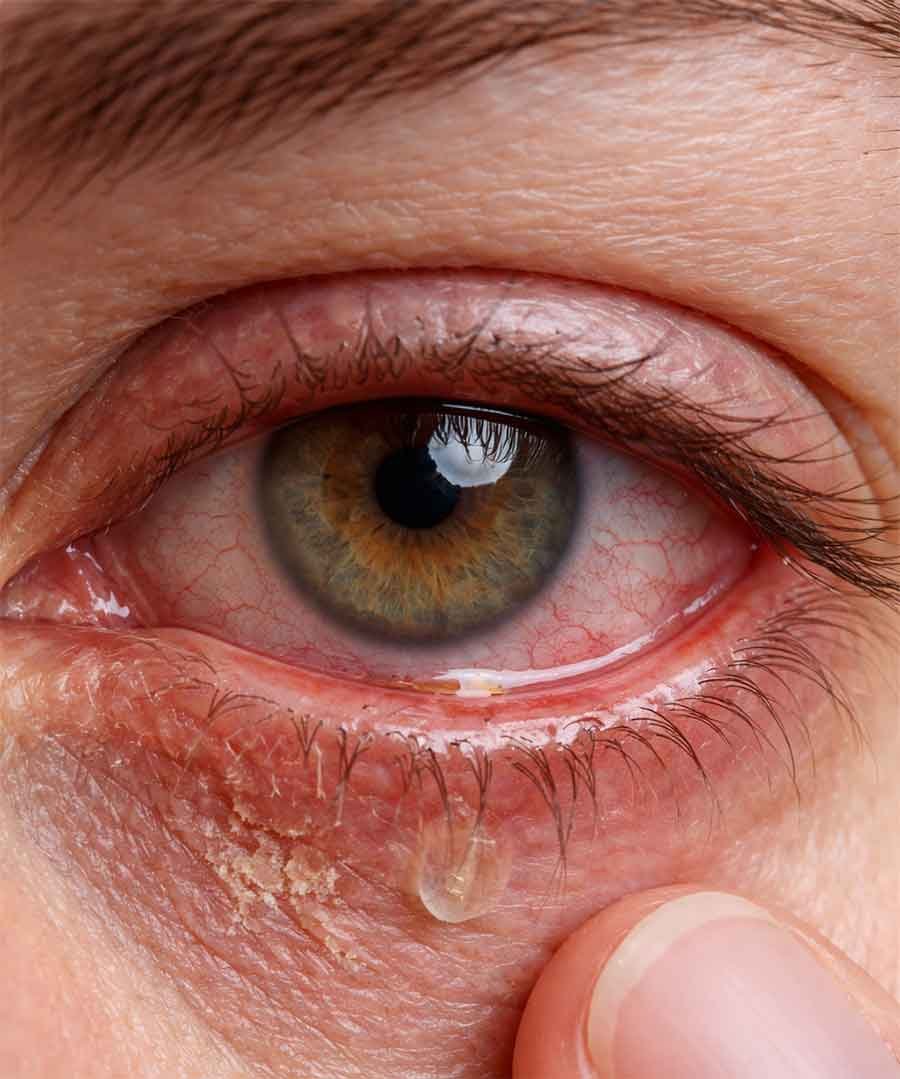 Occhio-secco-Dott.ssa-Fiamma-Ferraro-ChatGPT-Image-16-feb-2026,-18_13_17