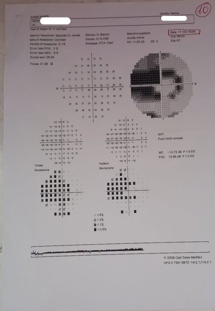 Caso-clinico-glaucoma_1
