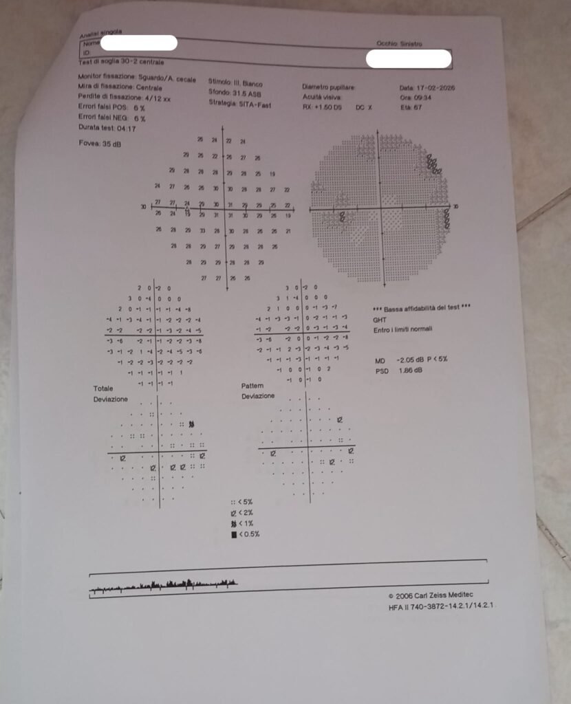 Caso clinico glaucoma_2