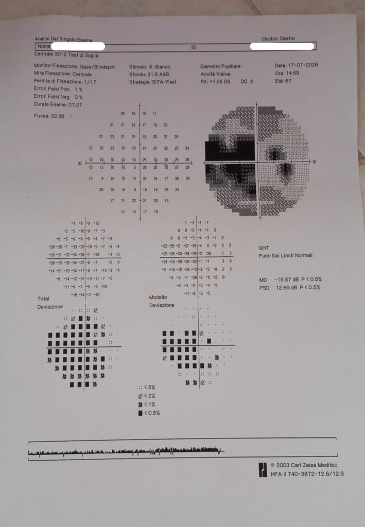 Caso clinico glaucoma_3