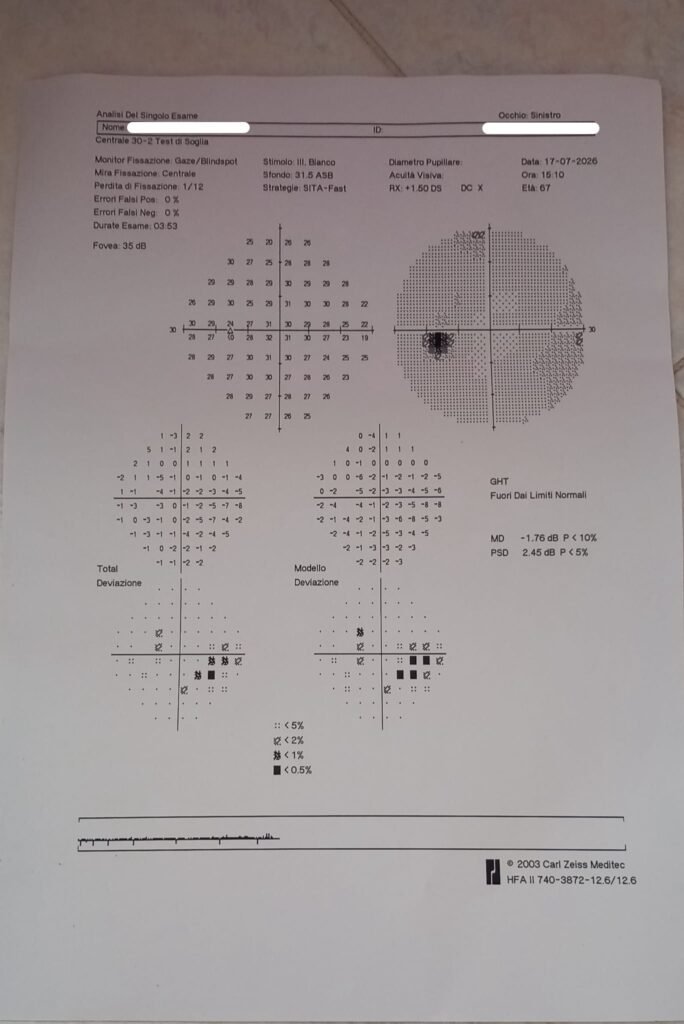 Caso clinico glaucoma_4