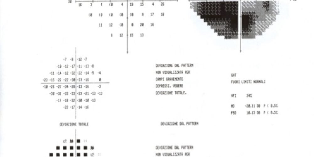 Nuovo caso di glaucoma trattato con agopuntura Boel.-Yamamoto-Ferraro