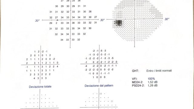 Glaucoma: un caso clinico diverso dagli altri