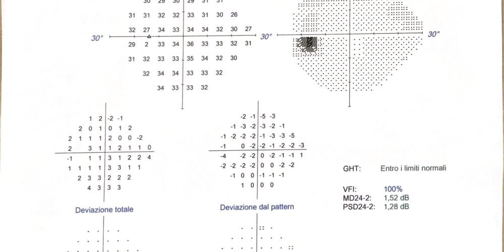 Glaucoma: un caso clinico diverso dagli altri