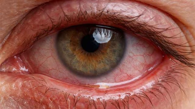 QUANDO GLI OCCHI SECCHI FANNO VERSARE LACRIME AMARE